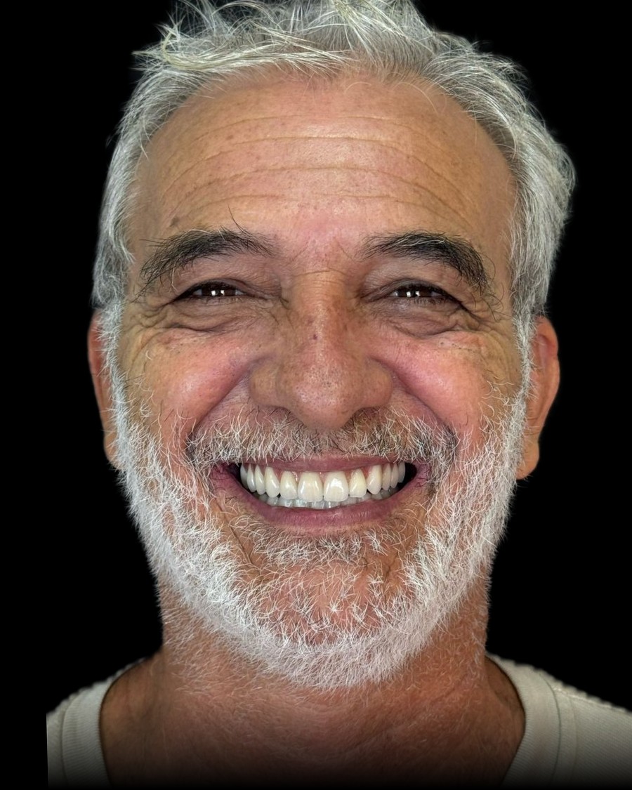 Resultado depois do tratamento no caso 1